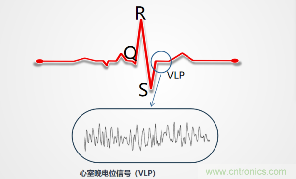 解決心電監(jiān)測行業(yè)難題，曼森伯格的濾波技術(shù)獲國家知識產(chǎn)權(quán)局發(fā)明授權(quán)